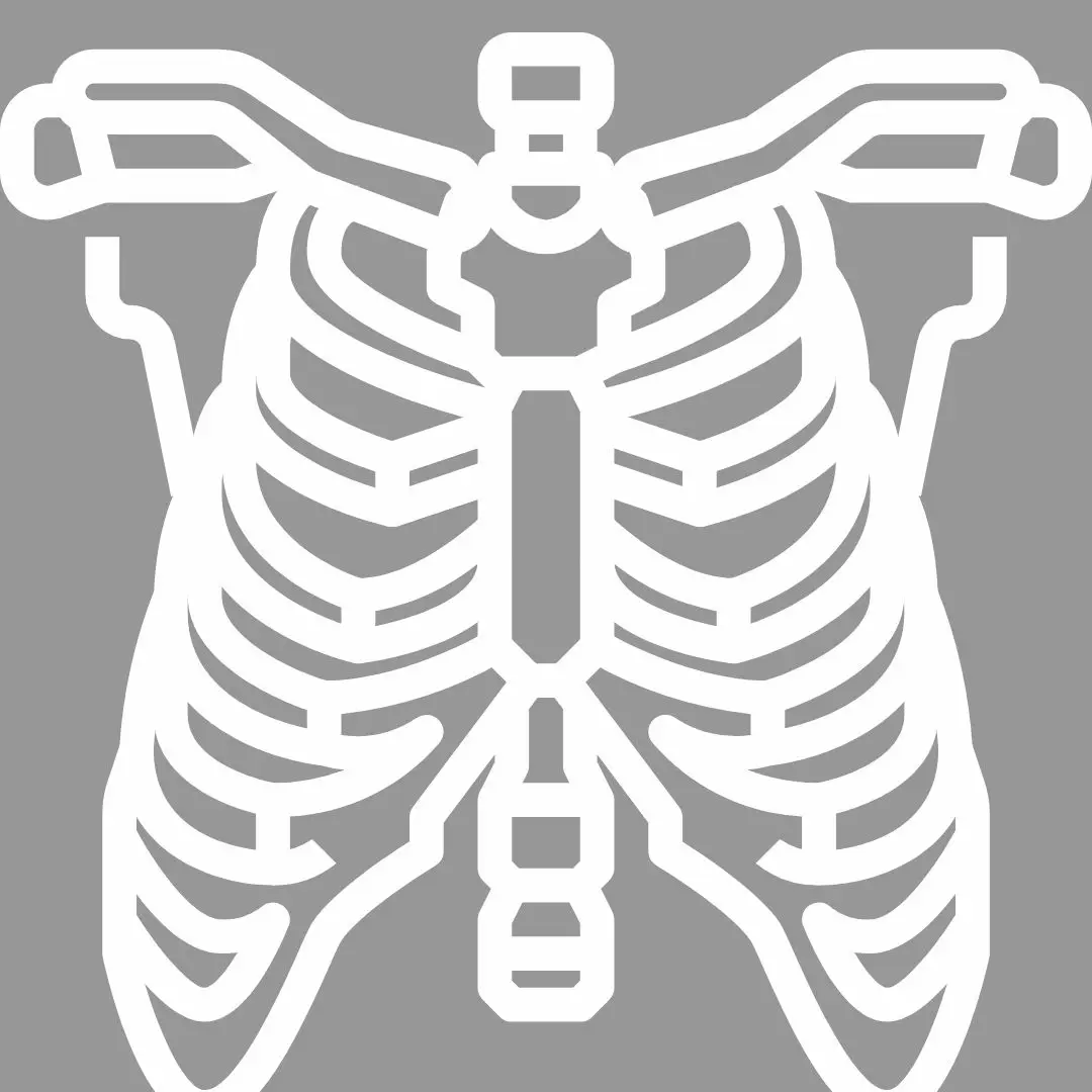 Cirurgia de Pectus por Vídeo