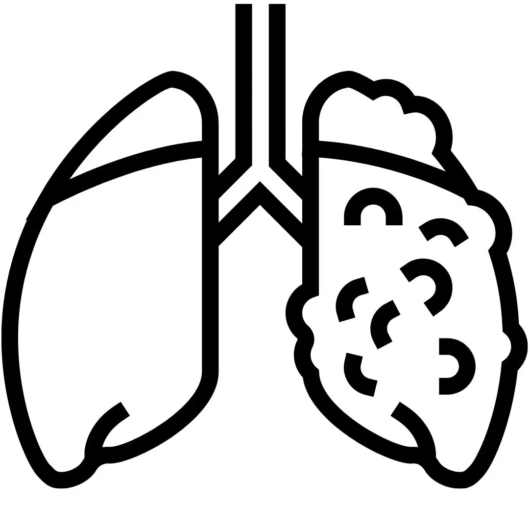 Cirurgia em Câncer de Pulmão