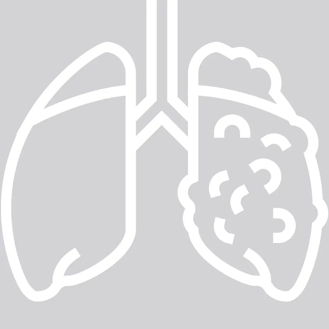 Cirurgia em Câncer de Pulmão