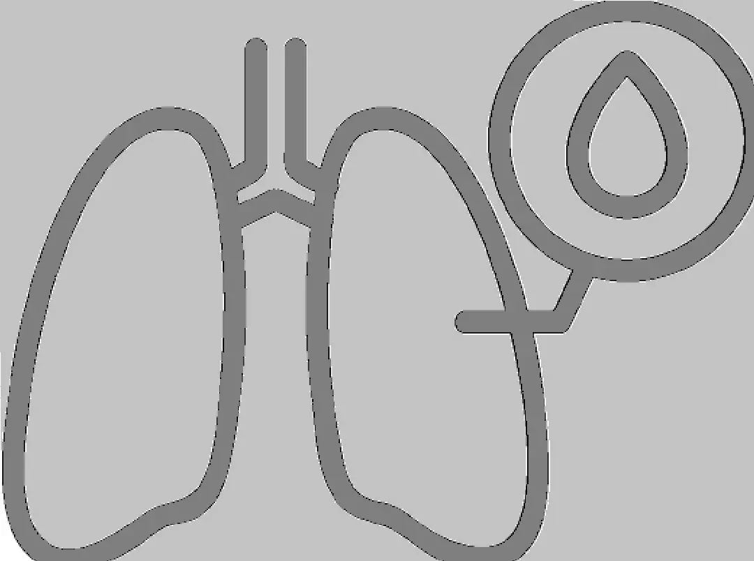 Pleurodese por Derrame Pleural